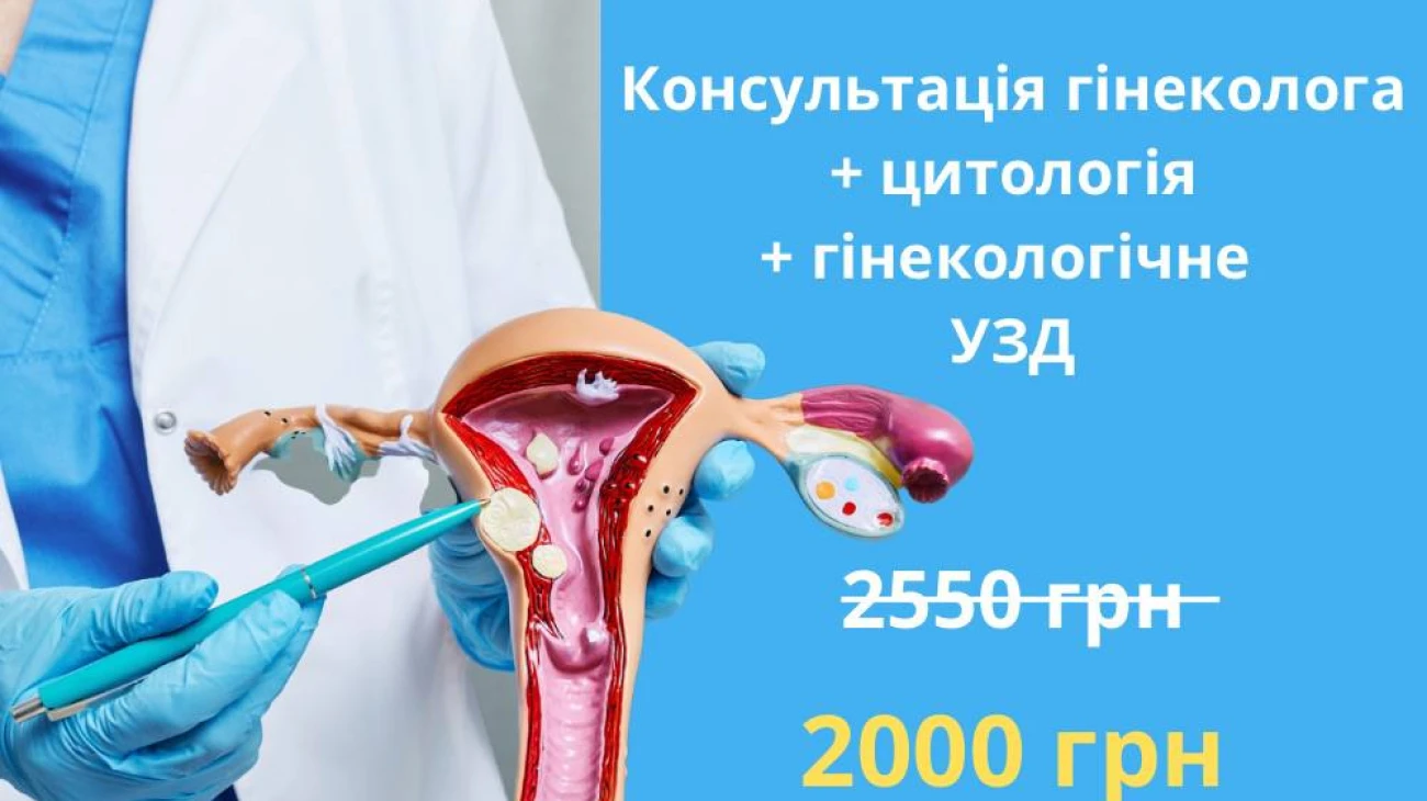 Консультация гинеколога + цитология + УЗИ – 2000грн (вместо 2550грн)